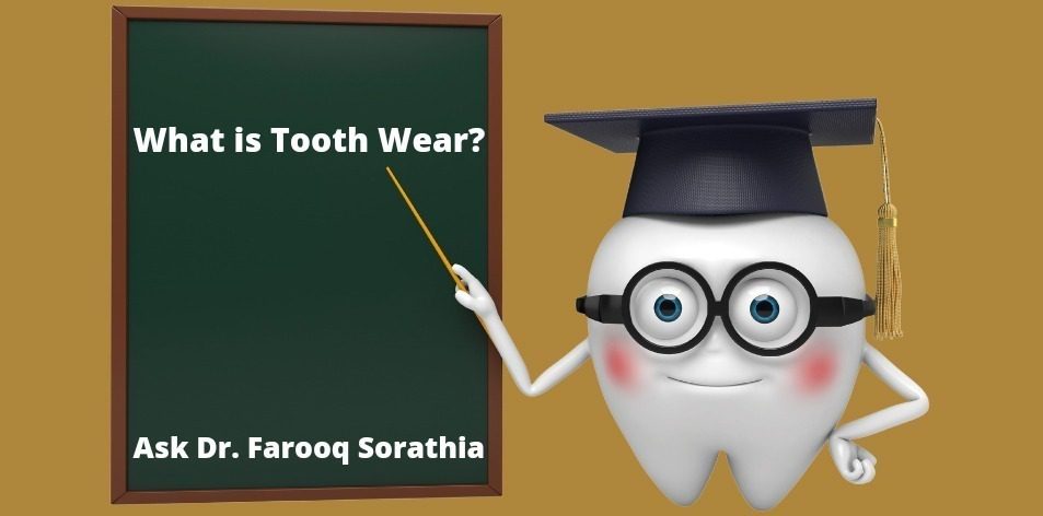 tooth wear