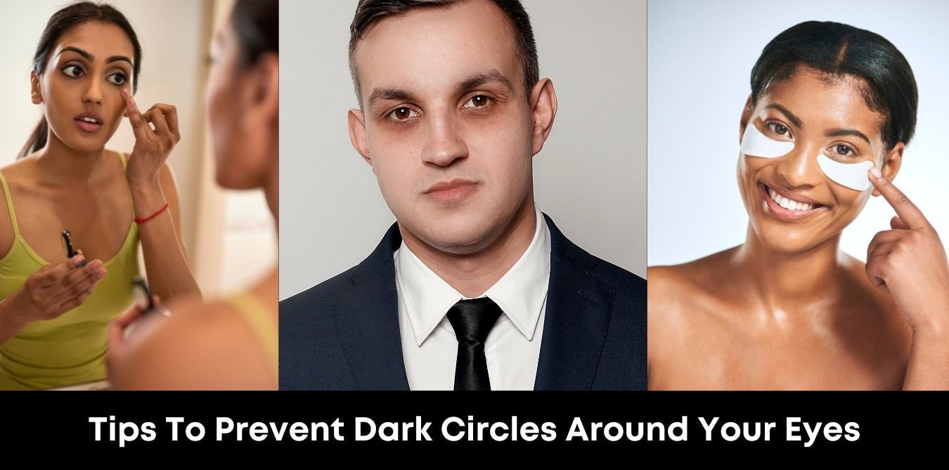 Tips To Prevent Dark Circles Around Your Eyes