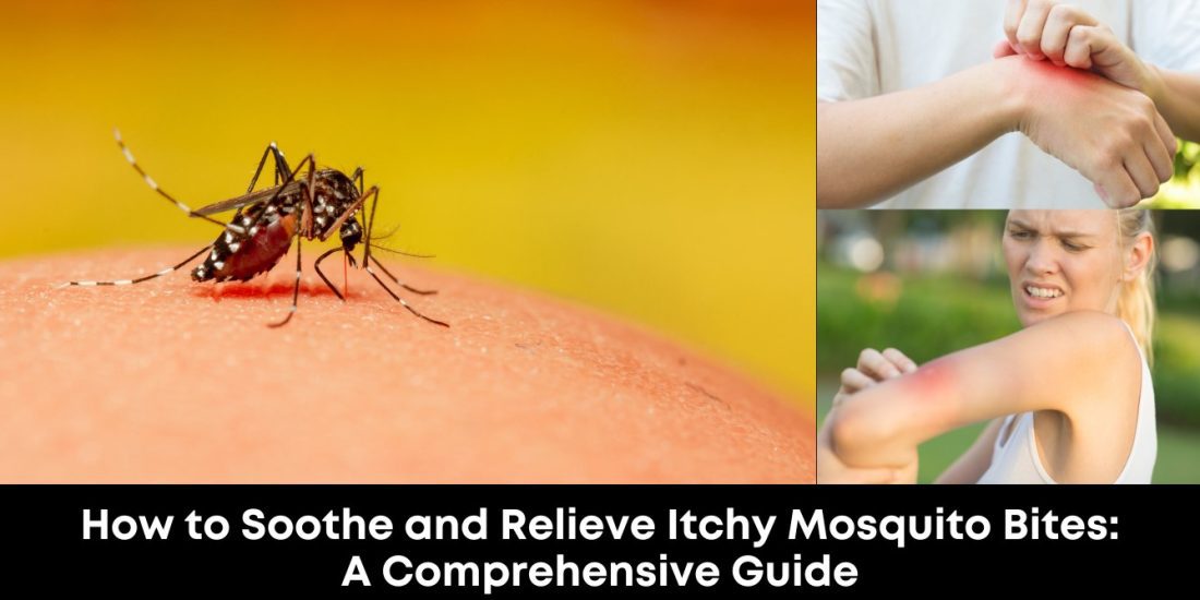 How to Soothe and Relieve Itchy Mosquito Bites A Comprehensive Guide