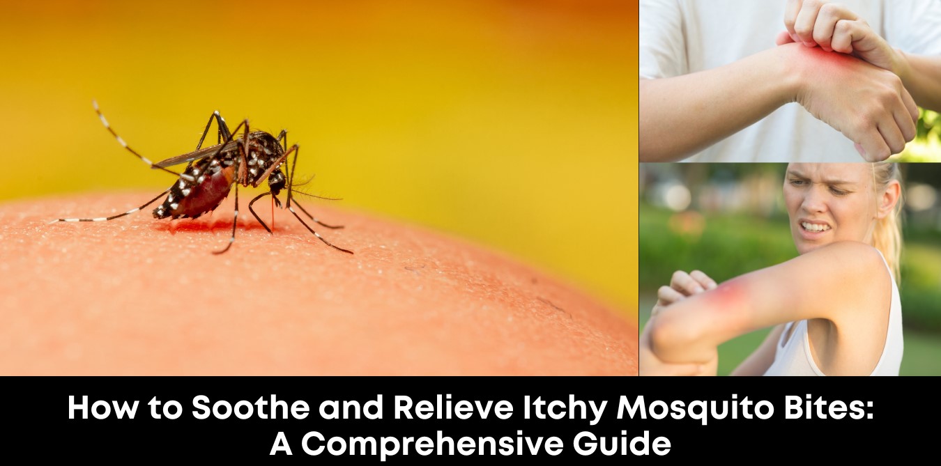 How to Soothe and Relieve Itchy Mosquito Bites A Comprehensive Guide