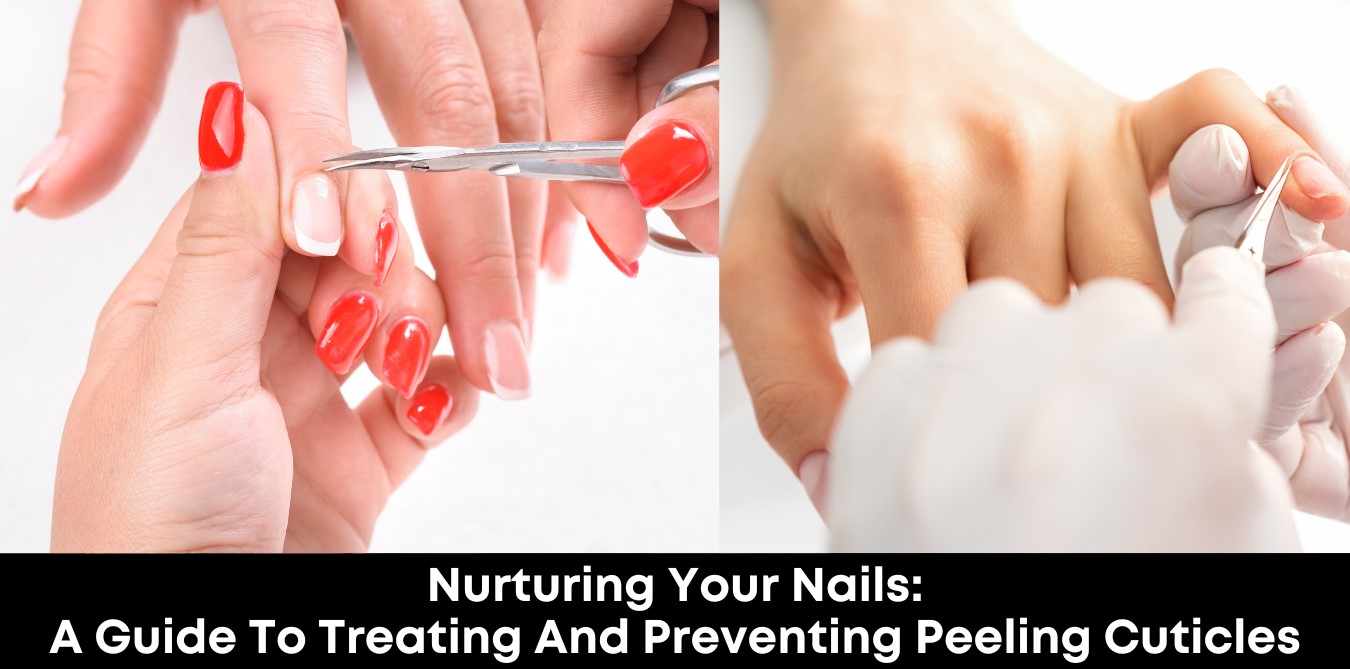 Nurturing Your Nails: A Guide to Treating and Preventing Peeling Cuticles