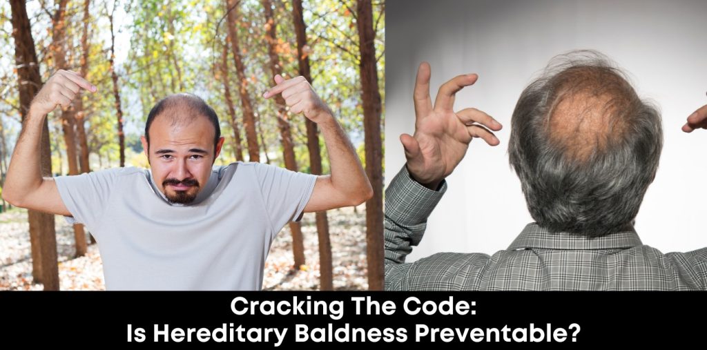 Cracking the Code Is Hereditary Baldness Preventable