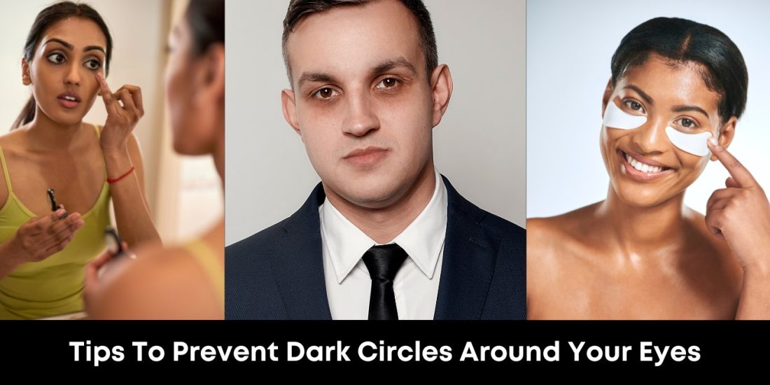Tips To Prevent Dark Circles Around Your Eyes